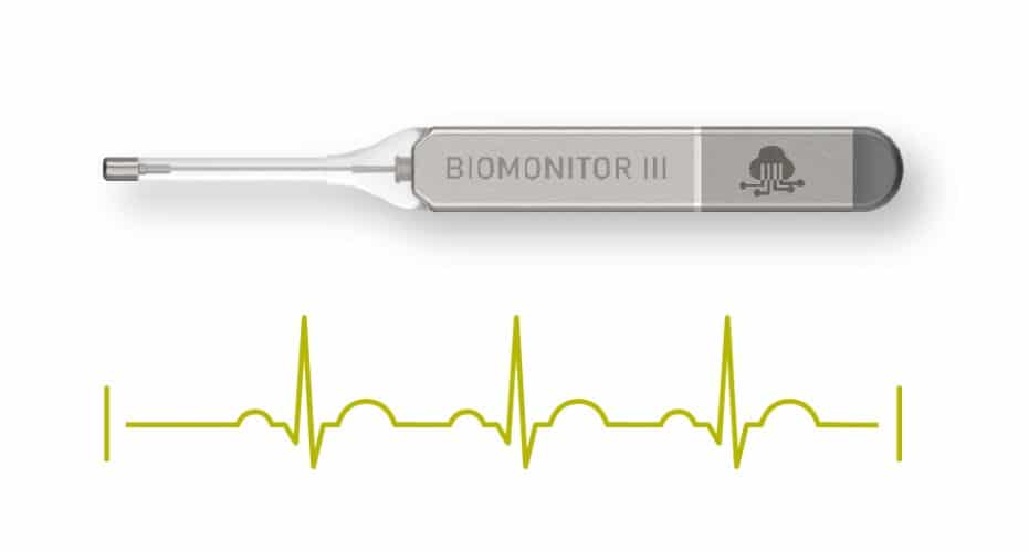 Implantable Loop Recorder