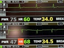 DexSmart-Black Leadless ICU Telemetry System