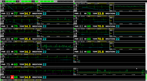 Cardio Explorer Software