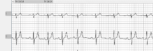 VMX00 Software